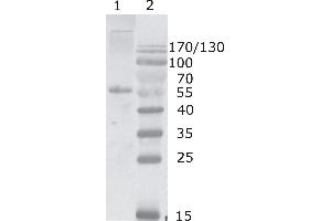 Western Blot testing of HIV-1 Gag p17/24 using HIV-1 p24 antibody, clone 2N32 (05-009). (HIV-1 p24 antibody  (AA 80-90))