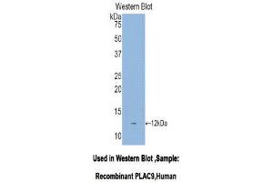 Western Blotting (WB) image for anti-Placenta-Specific 9 (PLAC9) (AA 23-97) antibody (ABIN1078445) (PLAC9 antibody  (AA 23-97))