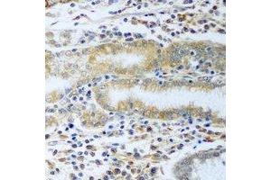 Immunohistochemical analysis of TCP1-delta staining in rat stomach formalin fixed paraffin embedded tissue section. (CCT4 antibody)