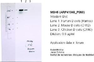 Western Blotting (WB) image for anti-MutS Homolog 6 (E. Coli) (MSH6) (N-Term) antibody (ABIN2776759) (MSH6 antibody  (N-Term))