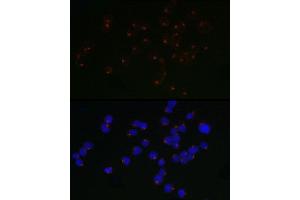 Immunofluorescence analysis of Jurkat cells using  / ARP Rabbit mAb (ABIN7265490) at dilution of 1:50 (40x lens). (ARFRP1 antibody)