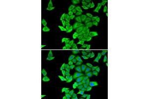 Immunofluorescence analysis of HeLa cells using SMYD2 antibody (ABIN5973871). (SMYD2A antibody)