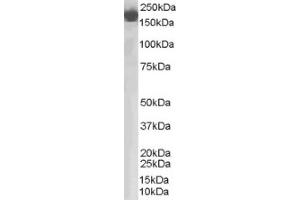 Image no. 1 for anti-Complement Factor H (CFH) (Internal Region) antibody (ABIN374588) (Complement Factor H antibody  (Internal Region))