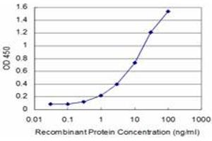 Detection limit for recombinant GST tagged FOXQ1 is approximately 0. (FOXQ1 antibody  (AA 110-219))