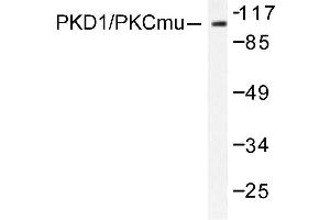 Image no. 1 for anti-Protein Kinase D1 (PRKD1) antibody (ABIN272067) (PKC mu antibody)
