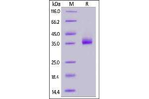 Biotinylated SARS-CoV-2 Spike RBD, His,Avitag (B. (SARS-CoV-2 Spike Protein (B.1.1.529 - Omicron, RBD) (His-Avi Tag,Biotin))