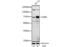 Western blot analysis of extracts of PC-12 cells, using EGR1 antibody (ABIN6133683, ABIN6139992, ABIN7101807 and ABIN7101808) at 1:1000 dilution. (EGR1 antibody  (AA 1-250))