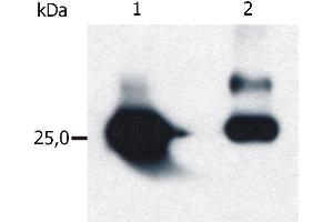 Isolation of Glutathione-S-Transferase (GST) overexpressed in E. (GST-Tag antibody)