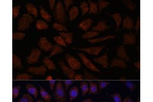Immunofluorescence analysis of L929 cells using OAS3 Polyclonal Antibody at dilution of 1:100. (OAS3 antibody)
