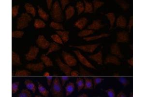 Immunofluorescence analysis of L929 cells using OAS3 Polyclonal Antibody at dilution of 1:100.