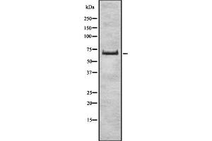 Western blot analysis of ZSCAN2 expression in HEK293 cells ,The lane on the left is treated with the antigen-specific peptide. (ZSCAN2 antibody  (Internal Region))