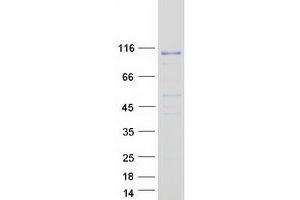 Validation with Western Blot