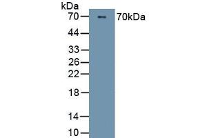 Detection of Recombinant PI16, Human using Polyclonal Antibody to Peptidase Inhibitor 16 (PI16) (PI16 antibody  (AA 28-247))