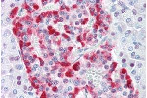 Immunohistochemistry (Paraffin-embedded Sections) (IHC (p)) image for anti-DNA Fragmentation Factor, 45kDa, alpha Polypeptide (DFFA) (AA 2-21) antibody (ABIN461876)