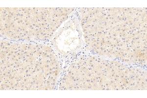 Immunohistochemistry (IHC) image for anti-Matrix Metalloproteinase 2 (MMP2) (AA 110-660) antibody (ABIN7425680)
