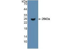 Western blot analysis of recombinant Human ACO1. (Aconitase 1 antibody  (AA 26-243))