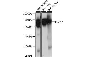 Western blot analysis of extracts of various cell lines, using PLVAP antibody (ABIN7269386) at 1:1000 dilution. (PLVAP antibody  (AA 63-442))