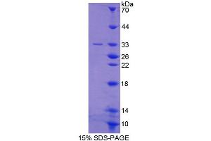 SDS-PAGE (SDS) image for Prostaglandin F2 Receptor Negative Regulator (PTGFRN) (AA 406-662) protein (His tag) (ABIN4988850) (PTGFRN Protein (AA 406-662) (His tag))