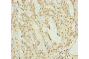Immunohistochemistry of paraffin-embedded human adrenal gland tissue using ABIN7158523 at dilution of 1:100 (ACSL6 antibody  (AA 458-697))