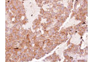 IHC-P Image Immunohistochemical analysis of paraffin-embedded HUH7 xenograft, using EIF3 zeta, antibody at 1:100 dilution. (EIF3D antibody)