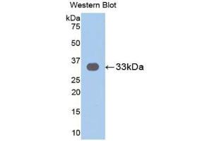 Detection of Recombinant IL31RA, Human using Polyclonal Antibody to Interleukin 31 Receptor A (IL31RA) (IL31RA antibody  (AA 205-456))