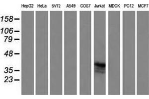 Western Blotting (WB) image for anti-T-cell surface glycoprotein CD1c (CD1C) antibody (ABIN2670659)