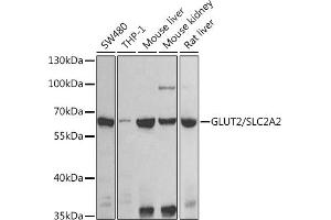 Western blot analysis of extracts of various cell lines, using GLUT2/GLUT2/SLC2 antibody (ABIN6134110, ABIN6147959, ABIN6147960 and ABIN6225170) at 1:1000 dilution. (SLC2A2 antibody  (AA 1-100))