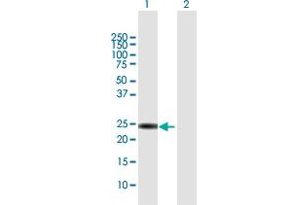 KIF26A antibody  (AA 1-203)