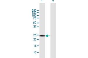 Western Blot analysis of KIF26A expression in transfected 293T cell line by KIF26A MaxPab polyclonal antibody.