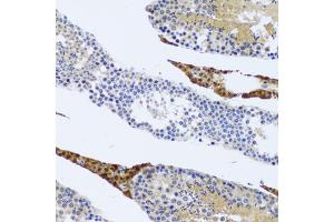 Immunohistochemistry of paraffin-embedded rat testis using FMOD antibody (ABIN2562633) at dilution of 1:100 (20x lens).