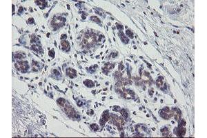 Immunohistochemical staining of paraffin-embedded Human breast tissue using anti-APP mouse monoclonal antibody. (APP antibody)