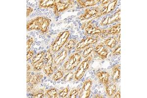 Immunohistochemistry of paraffin embedded rat kidney using Megalin (ABIN7074514) at dilution of 1:1000 (400x lens) (LRP2 antibody)