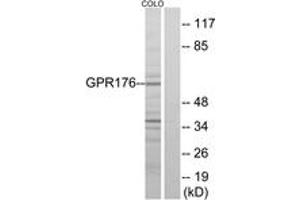 Western blot analysis of extracts from COLO205 cells, using GPR176 Antibody. (GPR176 antibody  (AA 466-515))
