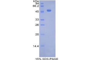 SDS-PAGE analysis of Mouse Pregnane X Receptor Protein. (NR1I2 Protein)
