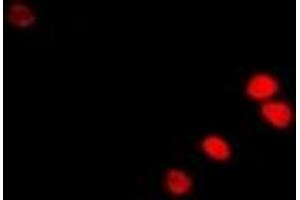 Immunofluorescent analysis of RAG-2 staining in U2OS cells. (RAG2 antibody)