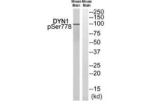 Western blot analysis of extracts from Mouse brain cells, using DYN1 (Phospho-Ser778) antibody. (Dynamin 1 antibody  (pSer778))