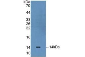 Detection of Recombinant IL10Ra, Human using Polyclonal Antibody to Interleukin 10 Receptor Alpha (IL10Ra) (IL-10RA antibody  (AA 132-235))
