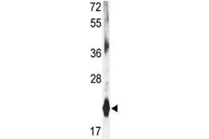 Western blot analysis of DHFR antibody and mouse liver tissue lysate