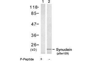 Image no. 1 for anti-Synuclein, alpha (SNCA) (pSer129) antibody (ABIN319236) (SNCA antibody  (pSer129))