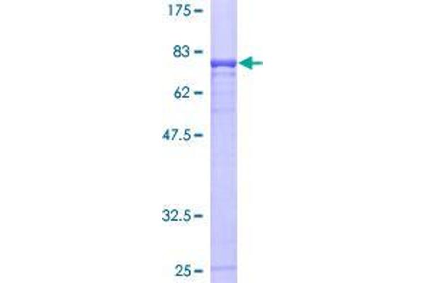 CBLC Protein (AA 1-474) (GST tag)