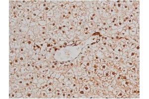 ABIN6267433 at 1/200 staining Rat liver tissue sections by IHC-P. (Filamin A antibody  (pSer2152))