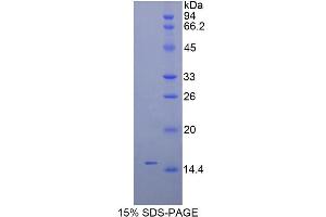 SDS-PAGE analysis of Mouse Inhibin beta C Protein.