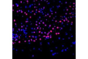 Immunofluorescence of paraffin embedded mouse brain using ZBTB40 (ABIN7076250) at dilution of 1:400 (300x lens) (ZBTB40 antibody)