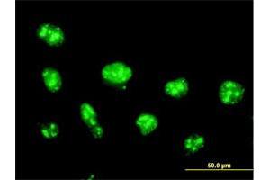 Immunofluorescence of purified MaxPab antibody to NOLC1 on HeLa cell. (NOLC1 antibody  (AA 1-700))