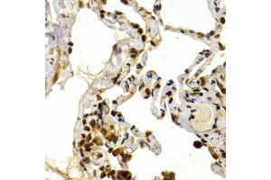 Immunohistochemistry of paraffin-embedded human normal lung using TFDP1 antibody at dilution of 1:200 (400x lens). (DP1 antibody)