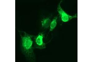 Image no. 2 for anti-CD163 (CD163) antibody (ABIN1497178) (CD163 antibody)