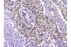 Immunohistochemistry (IHC) image for anti-T-Complex 1 (TCP1) (AA 515-551), (C-Term) antibody (ABIN5693078)