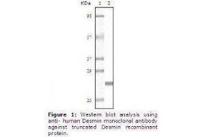Image no. 1 for anti-Desmin (DES) antibody (ABIN207624) (Desmin antibody)