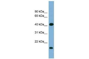 BXDC2 antibody used at 1 ug/ml to detect target protein. (BRIX1 antibody  (Middle Region))