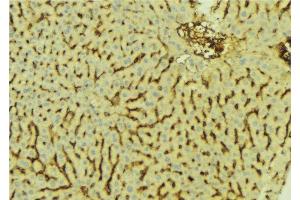 ABIN6276627 at 1/100 staining Mouse liver tissue by IHC-P. (AKR7A2 antibody  (Internal Region))